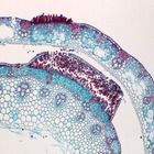 Puccinia graminis Microscope Slides, sec., 12 µm 