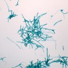 Moss Protonema, w.m. Microscope Slide | Carolina Biological Supply