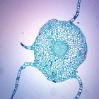 Moss Gametophyte Stem, cross section, Microscope Slide