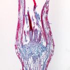 Mosses Microscope Slides (Protonema, Polytricum, Mnium)