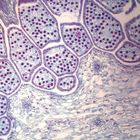Equisetum Mature Strobilus, l.s., 12 &#181;m Microscope Slide
