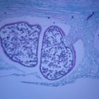 Lycopodium Strobilus Ls 12 Um Microscope Slide