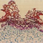 Elderberry Lenticel, c.s., 12 &#181;m Microscope Slide