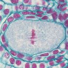 Lily Ovulary Microscope Slides, c.s., 12-20 µm