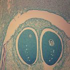 Pine Ovule, l.s., 12 &#181;m Egg Nucleus Microscope Slide