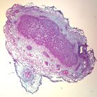 Legume Nodule, sec., 12 &#181;m Microscope Slide