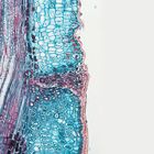 Abscission Layer, l.s., 12 &#181;m Microscope Slide