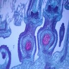 Dandelion Floral Head, l.s., 12 &#181;m Microscope Slide