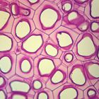 Dicot and Monocot Fruits and Seeds (Persimmon, Shepherd's Purse) Microscope Slides, l.s.