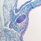 Lily Fruit Slide, c.s., 12 &#181;m