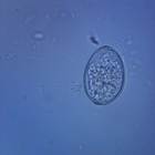 Diphyllobothrium latum Eggs, w.m. Microscope Slide