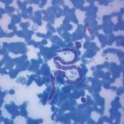 Dirofilaria Immitis Smear Microscope Slide