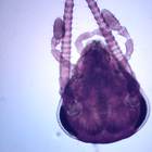 Cockroach Head, w.m. Microscope Slide