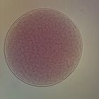 Starfish Unfertilized, w.m Microscope Slide