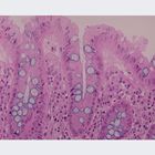 Epithelium Types Microscope Slide Set