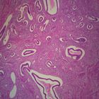 Uterus Microscope Slides