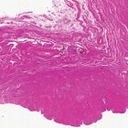 Human Vagina, sec. 7 &#181;m H&E Microscope Slide
