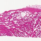 Prostate Gland Microscope Slides