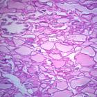 Human Thyroid, sec. 7 &#181;m H&E Microscope Slide