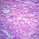 Human Thyroid Sec 7 Um H E Microscope Slide