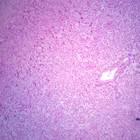 Human Adrenal Gland, sec. Thin Microscope Slide