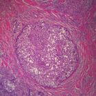 Human Digestive System Pathology Microscope Slides, sec. 7 µm H&E