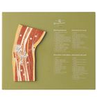 Somso&reg; Human Elbow Cross-Section Model