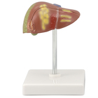 Altay&reg; Human Liver Pathology Model