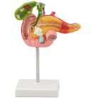 Altay Pathology Of The Human Pancreas Duodenum And Gallbladder Model