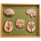 Somso 5 Section Models Of The Human Brain