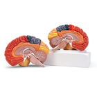 Altay&reg; Human Regional Brain Model