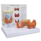 GPI Anatomicals&reg; Human Thyroid Model Set