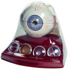 Somso Cataract Eye Model With 4 Forms Of Cataract