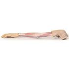 3-D Printed Superficial Dissection of the Upper Limb Model