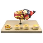 Eisco&reg; Model of Human Heart Conditions