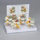 GPI Anatomicals&reg; Human Vertebrae Pathology Model Set, 4 Pieces
