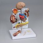 GPI Anatomicals&reg; Type 2 Diabetes Model 