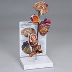 GPI Anatomicals&reg; Hypertension Model 
