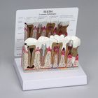 GPI Anatomicals&reg; Human Teeth Pathology Model