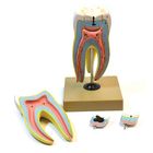 Eisco&reg; Human Upper Triple Root Molar with Interchangeable Cavities Model
