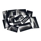 Fixed Bones X-Rays Set