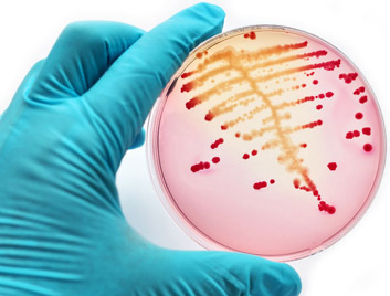 bacteria on a culture plate