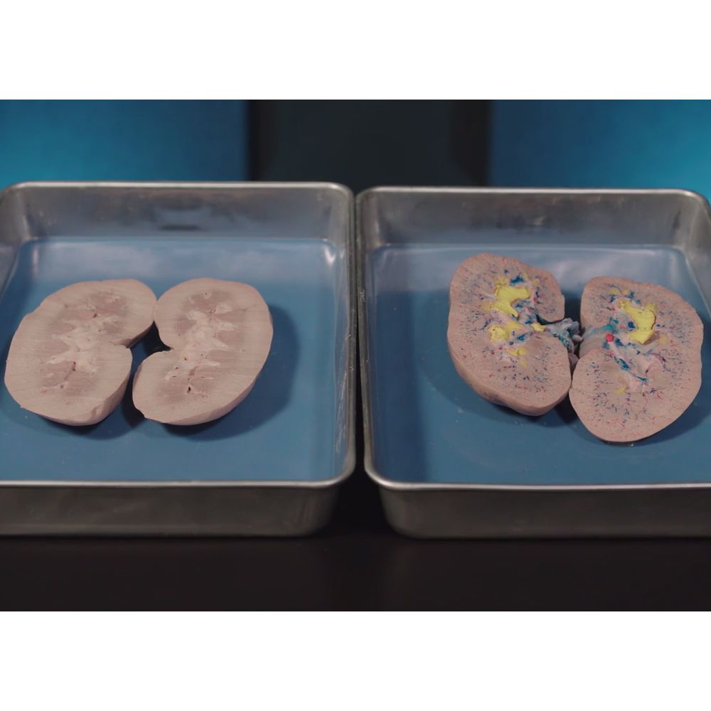 Carolina's Perfect Solution® Pig Kidneys Product Video