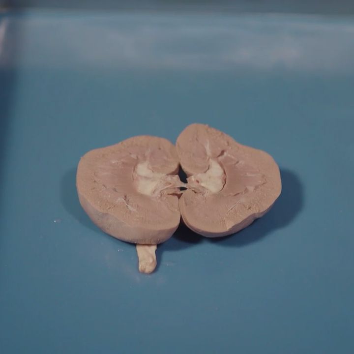 Carolina's Perfect Solution® Sheep Kidneys Product Video Carolina