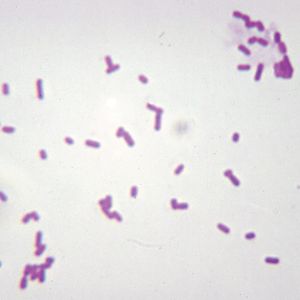 Real World Classroom Connections Hospital Acquired Infections And Super Bugs Carolina Com