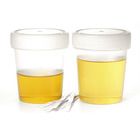 Developing and Analyzing Urine Samples as a Model of Kidney Function