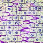 Squash an Onion and Learn the True Age of Your Cells