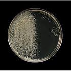 Fermentation by Yeast