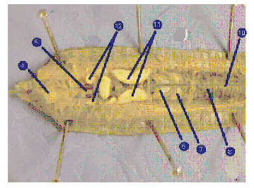 earthworm dissection observations hook into earthworm anatomy carolina earthworm dissection observations hook into earthworm anatomy carolina