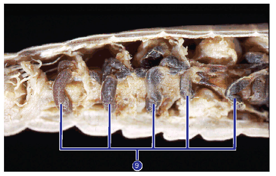 Hook Into Earthworm Anatomy